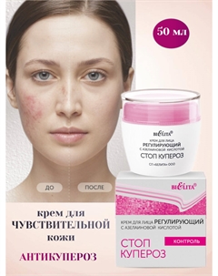 Стоп купероз Крем для лица регулирующий с азелаиновой кислотой 50мл Белита